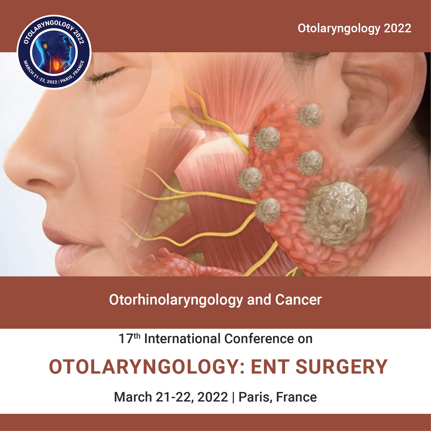Otorhinolaryngology and Cancer   Photo